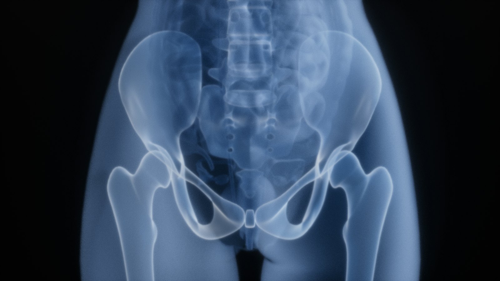 Radiografia da pelve e dos quadris